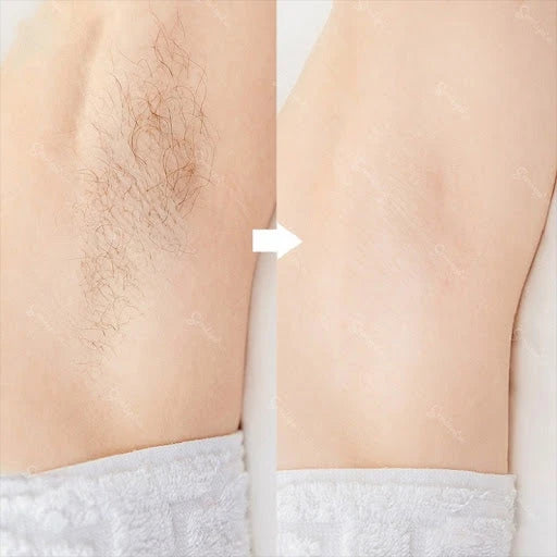 Hair Removal Oil